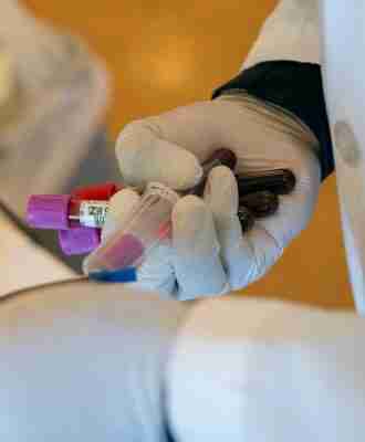 blood samples in hand