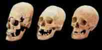 long skull with regular skulls
