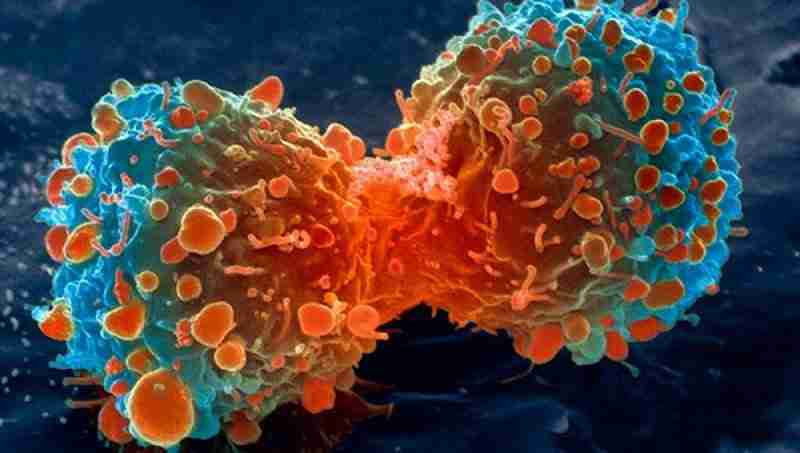 lung cancer cell dividing article v